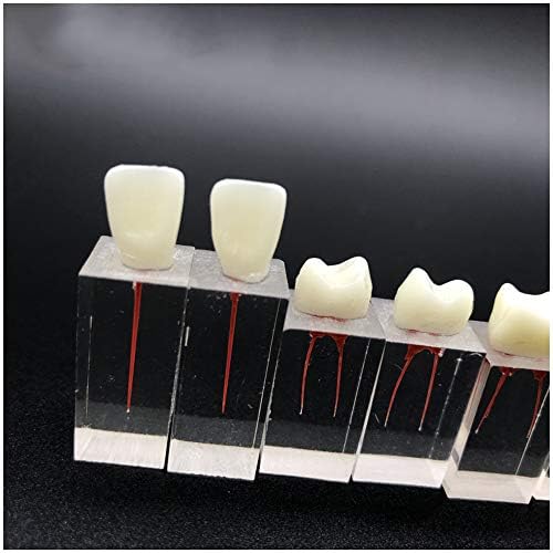 KH66ZKY 6 PCS PRÁTICA DE CANAL ROOTO Modelo de dentes dentários Modelo