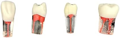 Canais de raiz Kh66zky com cavidade de celulose - modelo dental - modelo de dentes para ensinar crianças ou teste de habilidade oral, 5 pcs