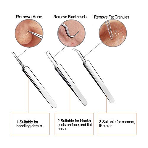 Kit de removedor de cravo - Feita Blackhead Tweezers Remonet Tool Kit Set - Acne Tweezers Pimple Comedone Extrator com