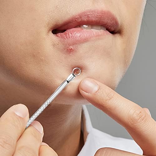 Removedor de cravo da Jawflew, ferramenta Pimple Popper, Extrator de comedonas Remoção de acne Ferramenta de aço de aço