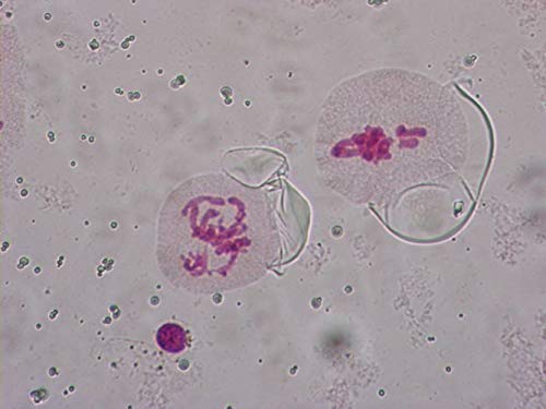 Preparado Mitose de Células de Plantas Animais Mitose Miose A amidose Comparação Microscópio Conjunto de lâminas, espécimes de 5pcs para exibir com os alunos na aula de biologia