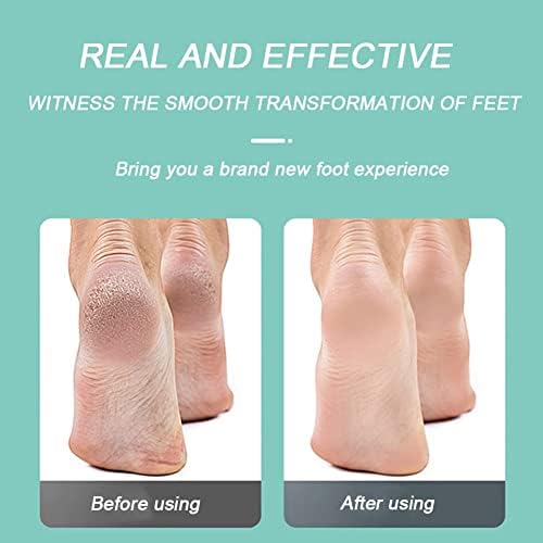 Novo pé elétrico moagem de pele ruptura dura Skin Trimmer Dead Skin Foot Pedicure