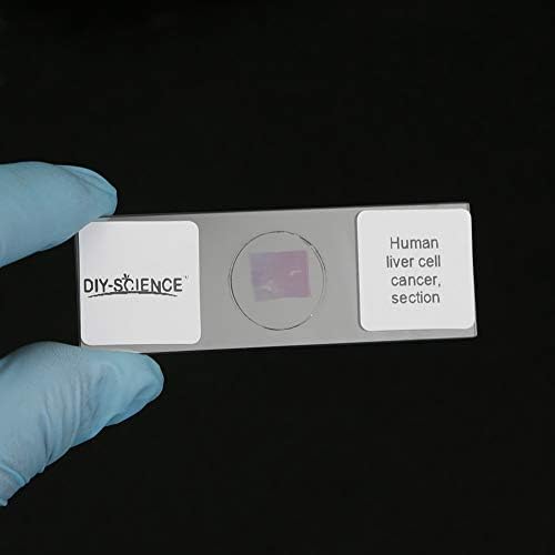 Conjunto de slides de microscópio de patologia humana preparada, 12pcs de qualidade de pesquisa de qualidade de pesquisa lâminas de microscópio de doenças humanas