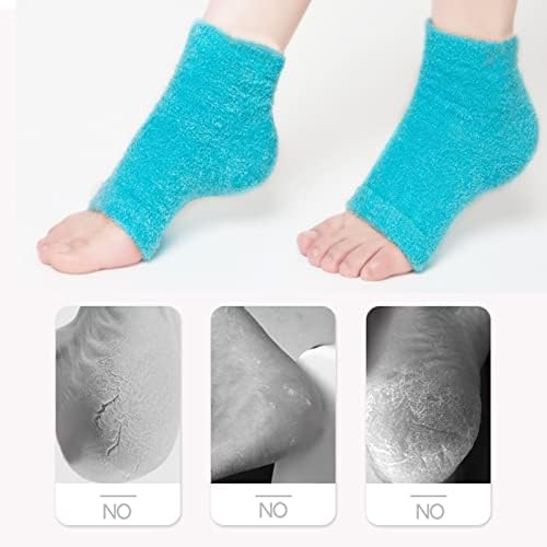 Meias de calcanhar hidratante 2 pares de salto hidratante de gel de silicone, meias para a pele seca e rachada de pé aberto meias de recuperação confortável